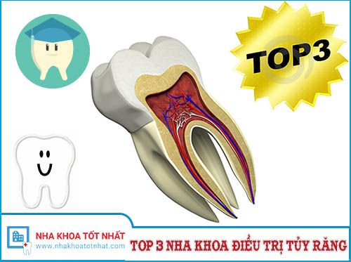 Top 3 Nha Khoa Điều Trị Tủy Răng Tại Hà Nội -1