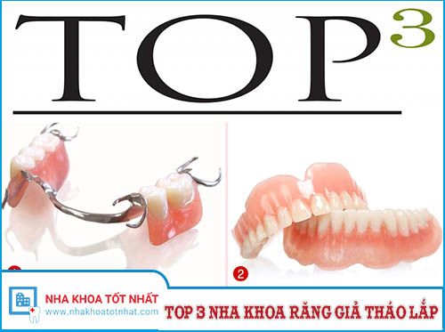 Top 3 Nha Khoa Làm Răng Giả Tháo Lắp Tại Hà Nội -1