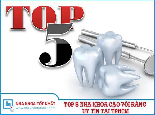 Top 5 Nha Khoa Cạo Vôi Răng Uy Tín Tại TPHCM -1