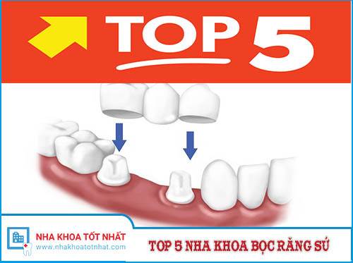 Top 5 Nha Khoa Bọc Răng Sứ Tại Hà nội -1