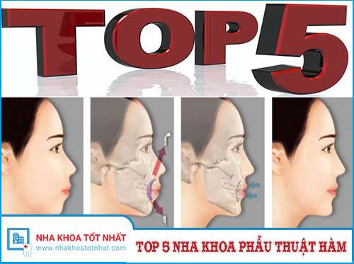 Top 5 Nha Khoa Phẫu Thuật Hàm Tại Hà nội -1