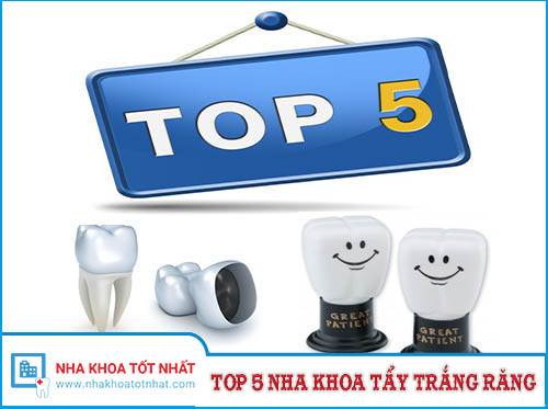 Top 5 Nha Khoa Tẩy Trắng Răng Tại Hà nội -1