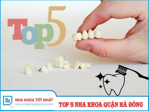 Top 5 Nha Khoa Quận Hà Đông -1