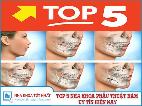 Top 5 Nha Khoa Phẫu Thuật Hàm Uy Tín Hiện Nay -1