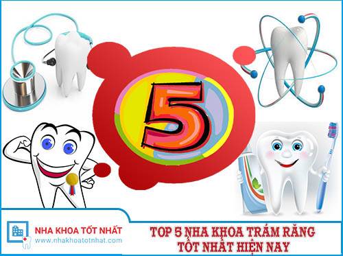 Top 5 Nha Khoa Trám Răng Tốt Nhất Hiện Nay -1