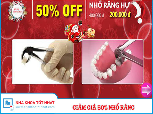 Giảm Giá 50% Nhổ Răng Nhân Dịp Noel 2016 -1