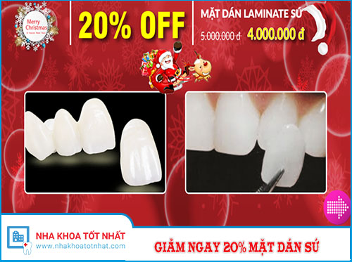 Khuyến Mãi Giảm Ngay 20% Mặt Dán Sứ Nhân Dịp Noel 2016 -1