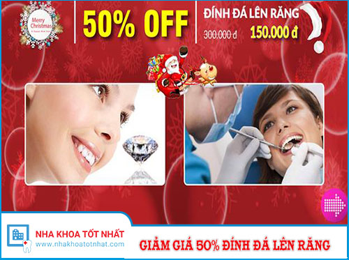 Giảm Giá 50% Đính Đá Lên Răng Nhân Dịp Tết 2017 -1