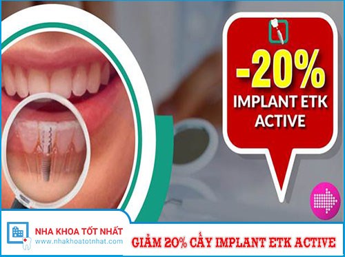 ƯU ĐÃI GIẢM 20% CHI PHÍ CẤY GHÉP IMPLANT ETK ACTIVE -1