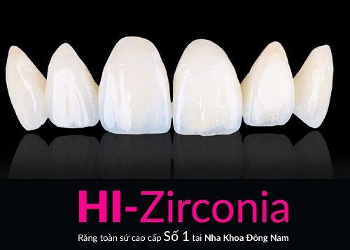 Giảm 20% Chi Phí Răng Sứ Cao Cấp HI-Zirconia Nhân Dịp 30/4 Và 1/5 -2