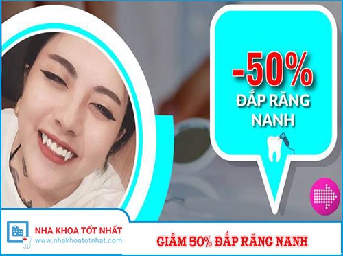 ƯU ĐÃI GIẢM 50% CHI PHÍ ĐẮP RĂNG NANH, RĂNG KHỂNH -1