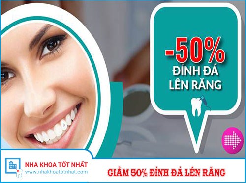 ƯU ĐÃI GIẢM 50% CHI PHÍ ĐÍNH ĐÁ LÊN RĂNG -1