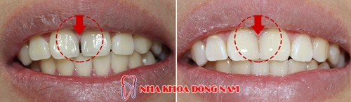 Đông Nam Khuyến Mãi 50% Cơ Sở Mới -6