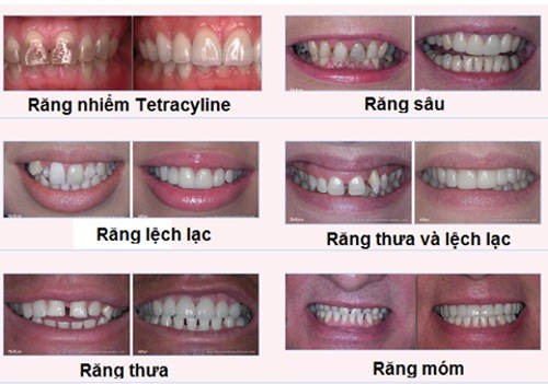 Nha Khoa Bình Trị -2