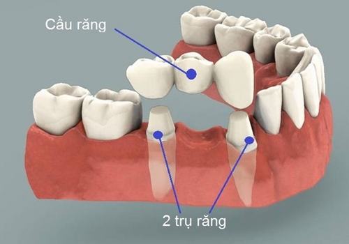 Nha khoa Bảo Châu -2