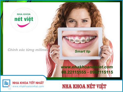 Nha khoa Nét Việt -1