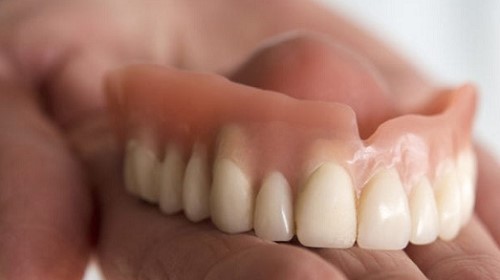 trồng răng implant tiết kiệm chi phí 2