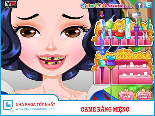 Game chăm sóc răng miệng Công Chúa