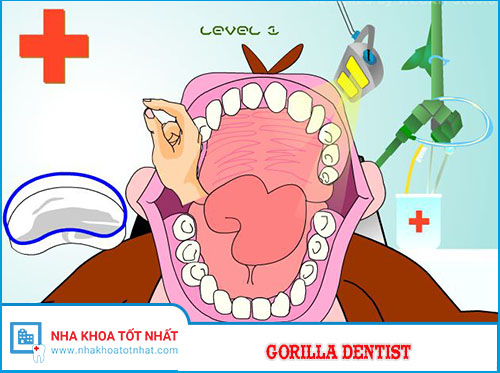 Gorilla Dentist