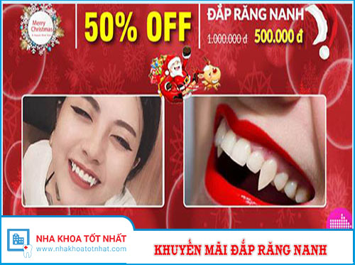 [Khuyến Mãi] Giảm Giá 50% Đắp Răng Nanh Nhân Dịp Noel 2016