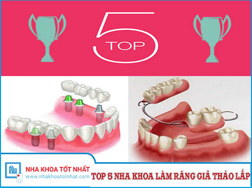 [REVIEW] Top 5 Nha Khoa Làm Răng Giả Tháo Lắp Tại TPHCM