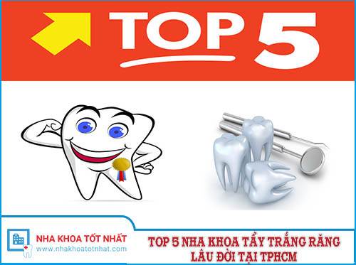[REVIEW] Top 5 Nha Khoa Tẩy Trắng Răng Lâu Đời Tại TPHCM
